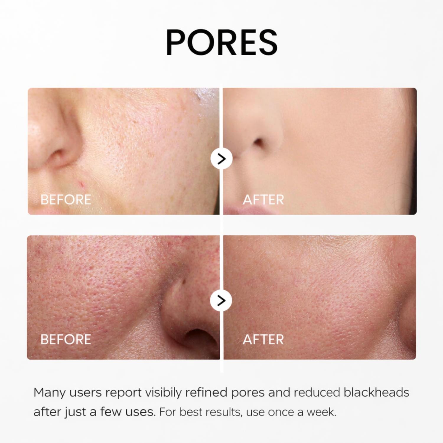 Rice Peel Glow Serum