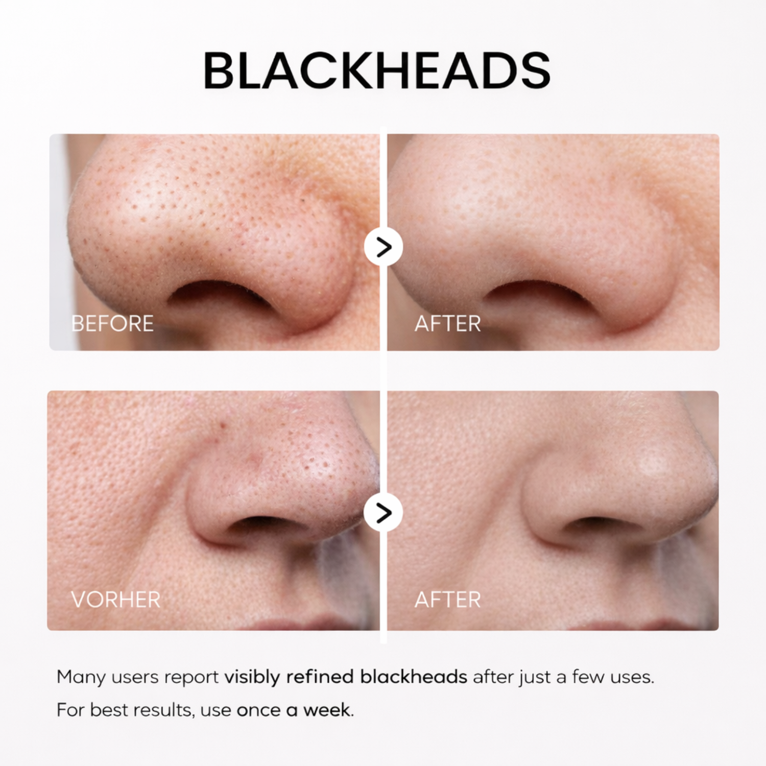 Rice Peel Glow Serum